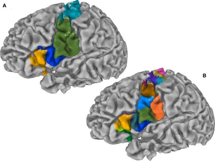 Cortex parcellation in brain imaging. From wikimedia.org